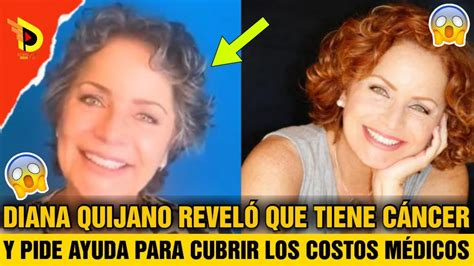 Diana Quijano Revel Que Tiene C Ncer Y Pide Ayuda Para Cubrir Los