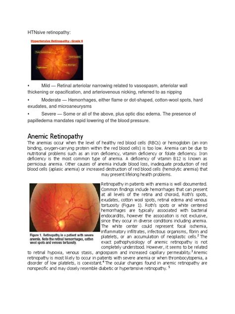 Htnsive Retinopathy Leukemia Anemia