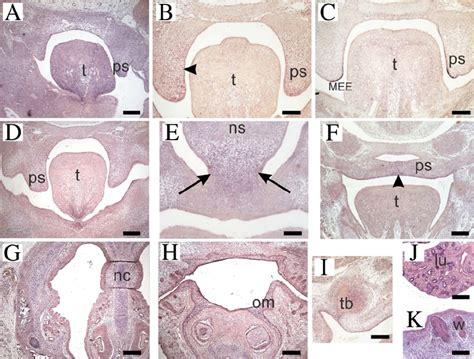 Tbx22 Expression In The Developing Mouse E12 5 E17 5 A B And D