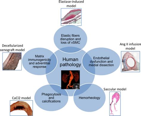 Translational Relevance And Recent Advances Of Animal Models Of