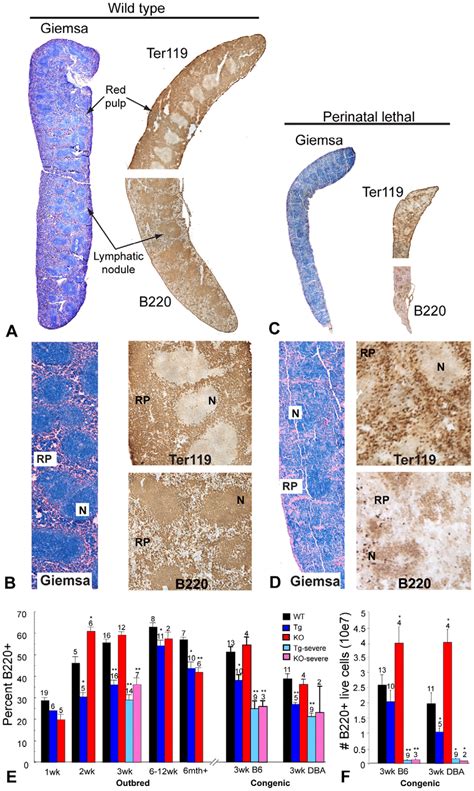 Altered Spleen Architecture And B Lymphocyte Profile In The Collagen X Download Scientific