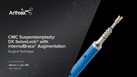 Arthrex Cmc Suspensionplasty Using Dx Swivelock® With Internalbrace™ Ligament Augmentation