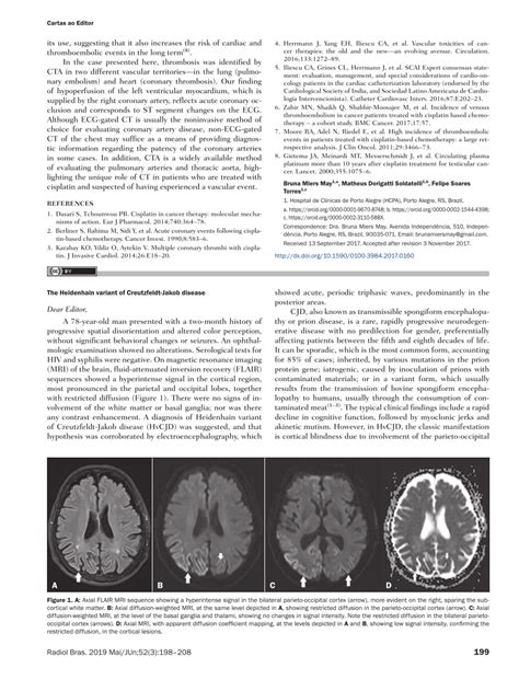 Pdf The Heidenhain Variant Of Creutzfeldt Jakob Disease