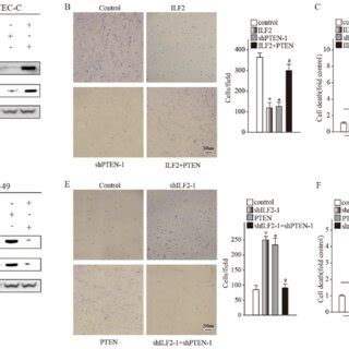 ILF2 Reduces Cell Matrix Adhesion And Promotes Anchorage Independence