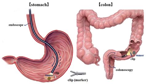 Free Clip Full Stomachs Download Free Clip Full Stomachs Png Images