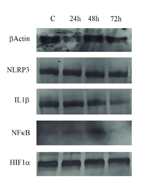 Western Blotting Analysis Of Hif 1α Il 1β The Nlrp3 Inflammasome And