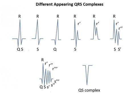 What Is An Rsr Prime Rsr Pattern On An Ecg Executive