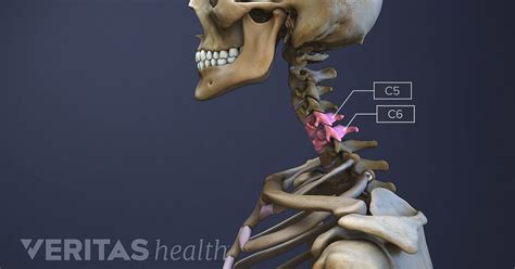 All About The C5 C6 Spinal Motion Segment