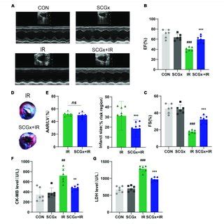 Sympathetic Denervation Improves Cardiac Function In Mice With