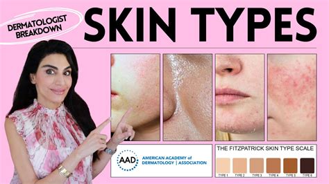 How To Know Your Skin Type Dermatologist Breaks Down Fitzpatrick Scale And More Youtube