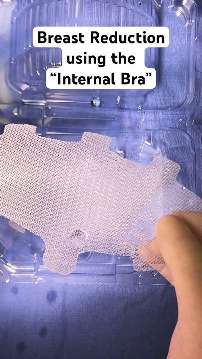 Dr Farber Discusses Breast Reduction Technique Using The Internal Bra With Galaflex Mesh Youtube