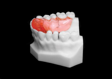 Removable Anterior Bite Plate Universal Orthodontic Lab