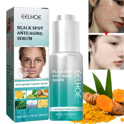 Turmeric Whitening Freckle Serum Brighten Remove Dark Spots Melasma