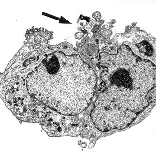 Platelet Adhesion To HUVEC Monolayers After Blockade Of Platelet