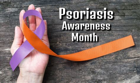 Psoriasis Awareness Month Learn More About Symptoms And Treatment