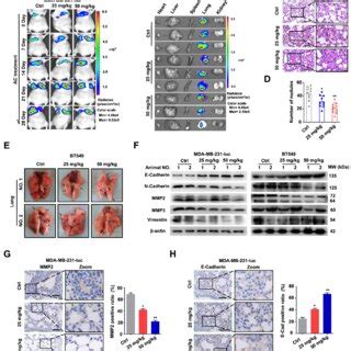 Anomanolide C Induces Ferroptosis Is Related To Autophagy Activation In