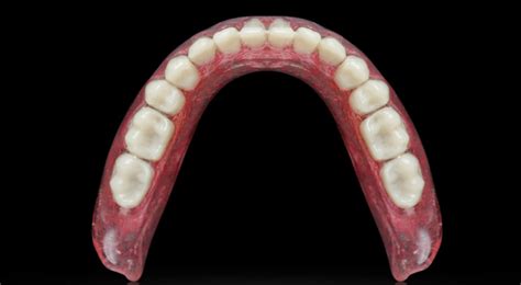 Dental Prosthetics