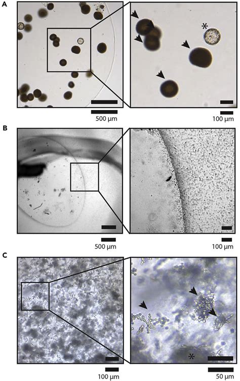 Bacterial And Fungal Infections In Organoid Cultures A Bacterial