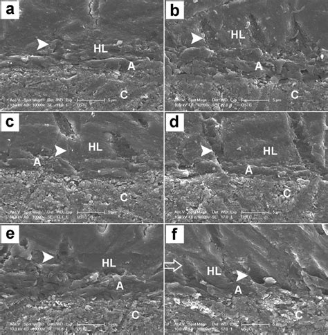 -SEM micrographs (×10,000) of resin-dentin bonding interface among the ...