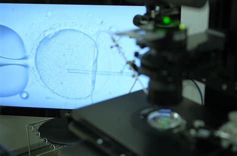 顕微授精（icsi） 兵庫県神戸市の山下レディースクリニック