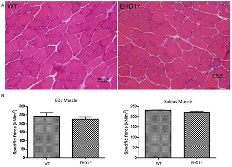 Eps15 Homology Domain Containing EHD 1 Skeletal Muscle Shows Normal