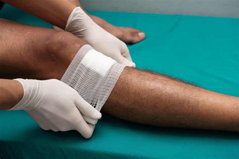 Venous Leg Ulcer Treatment Specialists West Coast Wound