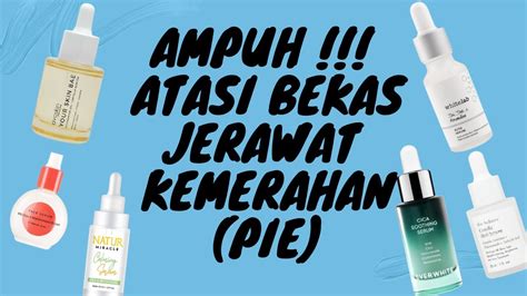 6 Serum Untuk Bekas Jerawat Kemerahan Pie Dengan Kandungan Centella Asiatica Youtube