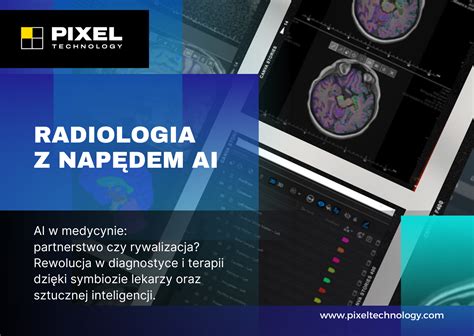 Ai W Medycynie Partnerstwo Czy Rywalizacja Rewolucja W Diagnostyce I