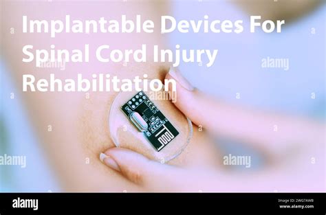 Implantable devices for spinal cord injury rehabilitation: Devices that ...