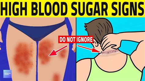 Top 7 Prediabetes Signs You Shouldn T Ignore Youtube