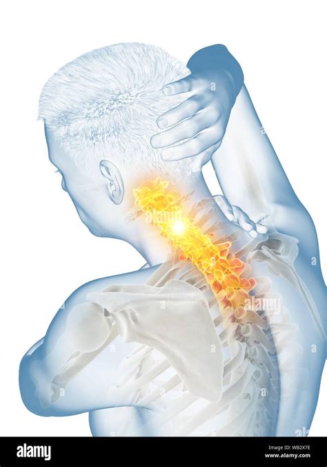 Neck Pain Conceptual Illustration Stock Photo Alamy