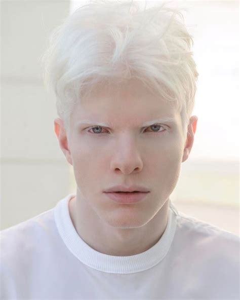 Albino Men Male Models Albino Model Modelo Albino Just Beautiful Men Beautiful People