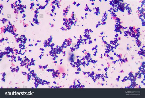 Gram Staining Called Grams Method Method Stock Photo 287276999