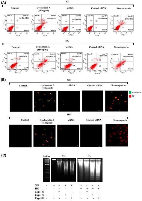 Cyclophilin A Induces Apoptosis Of High Glucose Primed Macrophages Thp