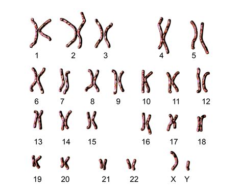 Caryotype Quest Ce Que Cest Fiches Sant Et Conseils M Dicaux