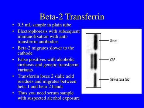 Ppt Csf Leaks Diagnosis And Management Powerpoint Presentation