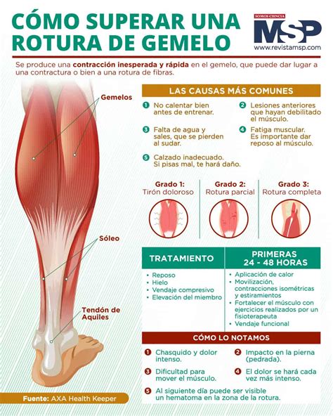 C Mo Superar Una Rotura De Gemelos