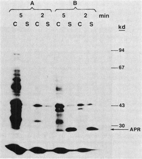 Autoradiogram Of 35s Methionine Labeled Proteins From Strains Br151