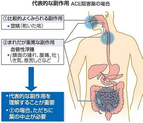 （2）副作用 過度に恐れず理解を 真鍋洋平｜岡山の医療健康ガイド Medica