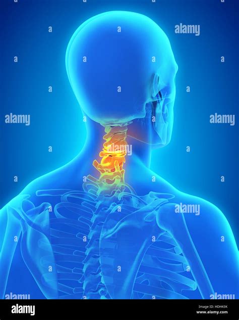 Vertebra Cervicales Humana Fotografías E Imágenes De Alta Resolución