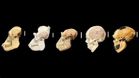 Human Specific Genes Implicated In Brain Size The Scientist Magazine®