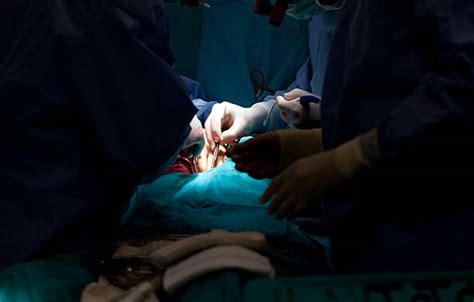 10,600+ Heart Surgery Stock Photos, Pictures & Royalty-Free Images - iStock