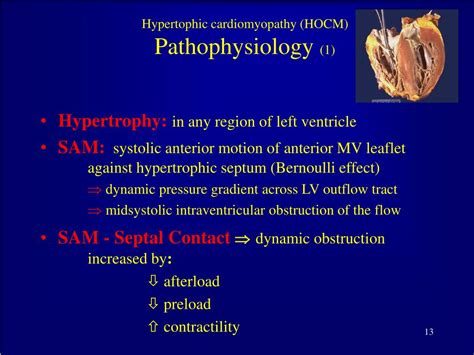 Ppt Hypertrophic Obstructive Cardiomyopathy Case Presentation