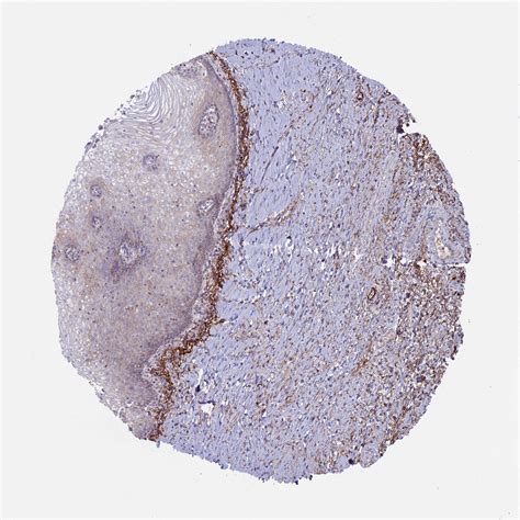 Tissue Expression Of Ptpn9 Staining In Vagina The Human Protein Atlas