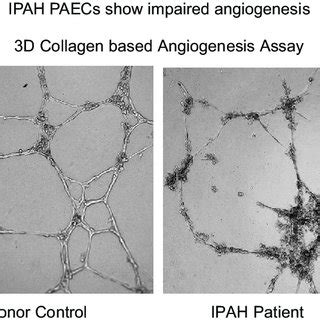 Schema Of Proposed Harvest Of Pulmonary Artery PA Endothelial Cells