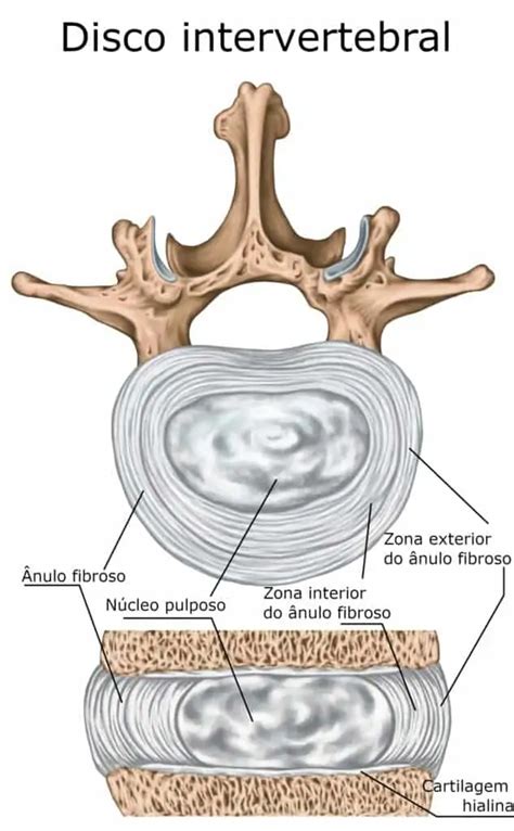 Fissura Do Nulo Fibroso Traumatologia E Ortopedia