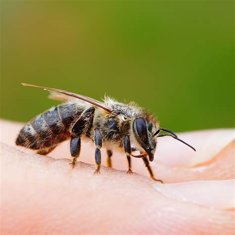 Treat Bee Sting On Foot