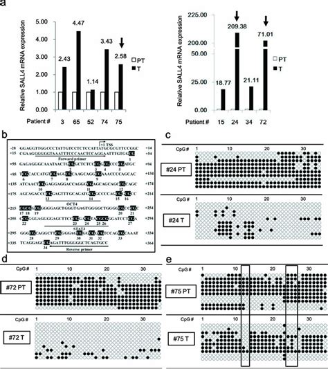 Sall4 Expression Is Associated With Dna Demethylation In A Subgroup Of