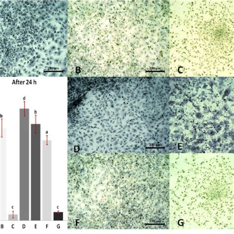 Morphology Of Cardiac Progenitor Cells Cultured With The Addition Of 10