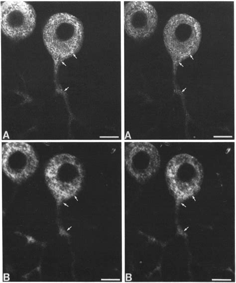 Paired Stereo Images Of Cerebellar Purkinje Neurons Labeled